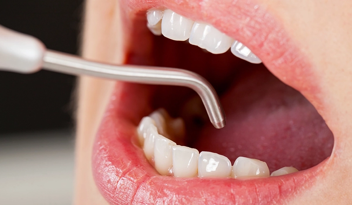 エアフローとは何か？