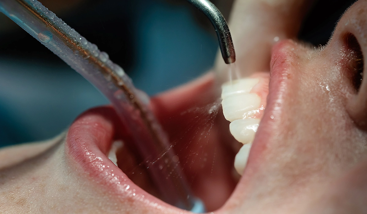 メンテナンスでエアフローを受けるべき理由